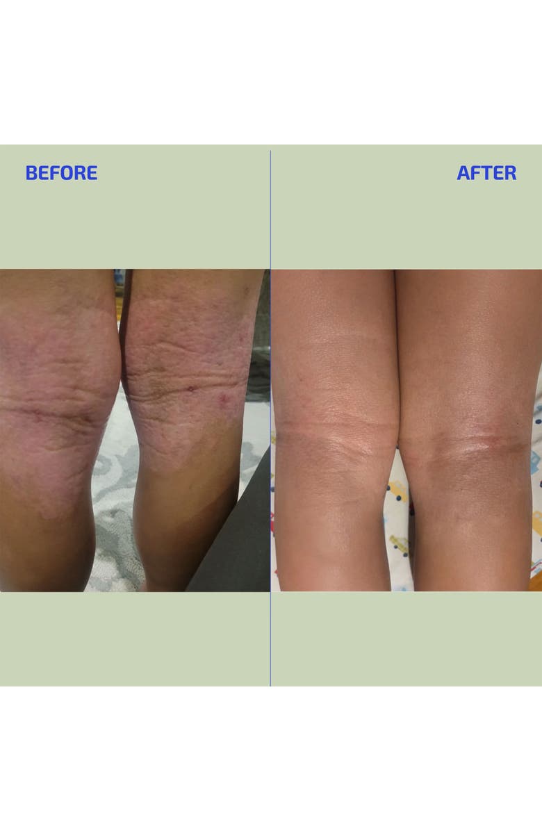 Codex Labs BIA Eczema Relief Lotion, Alternate, color, Tan