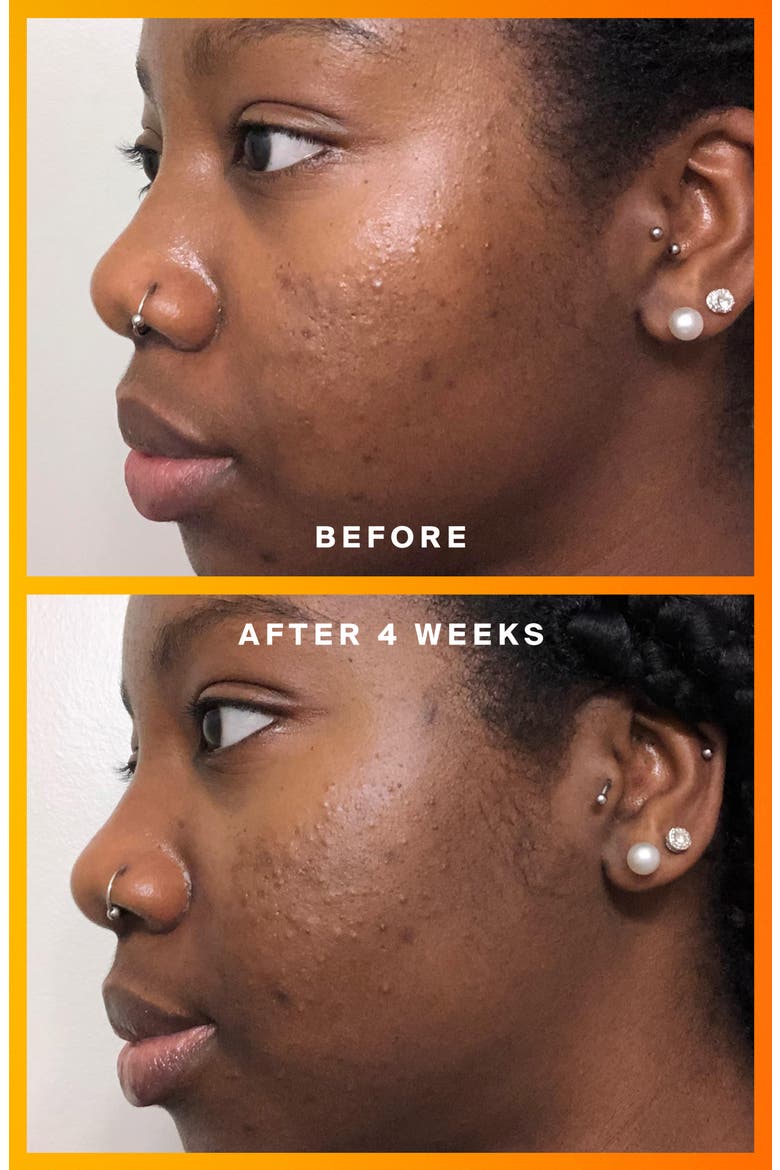 Daily Dose Vitamin C + SPF 40 Serum, Alternate, color, NO COLOR