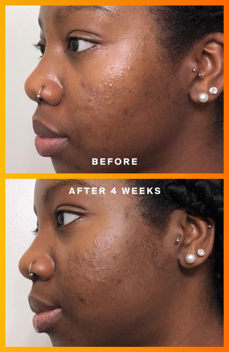 Supergoop!<sup>®</sup> Daily Dose Vitamin C + SPF 40 Serum, Alternate, color, 