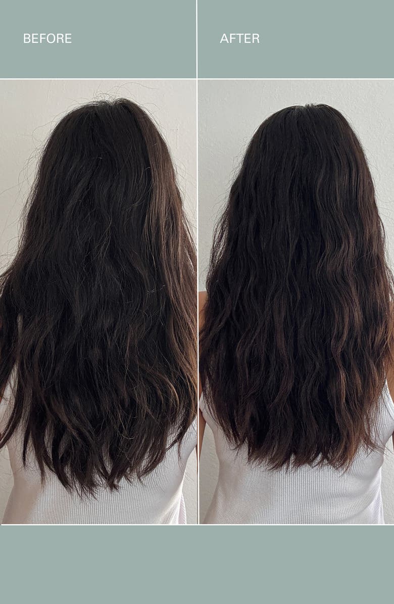 ROZ Healthy Hair & Scalp Kit $181 Value, Alternate, color,