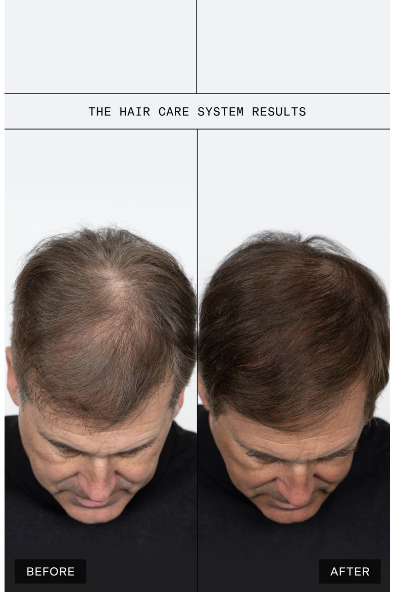 The Hair Care System Set, Alternate, color, NO COLOR