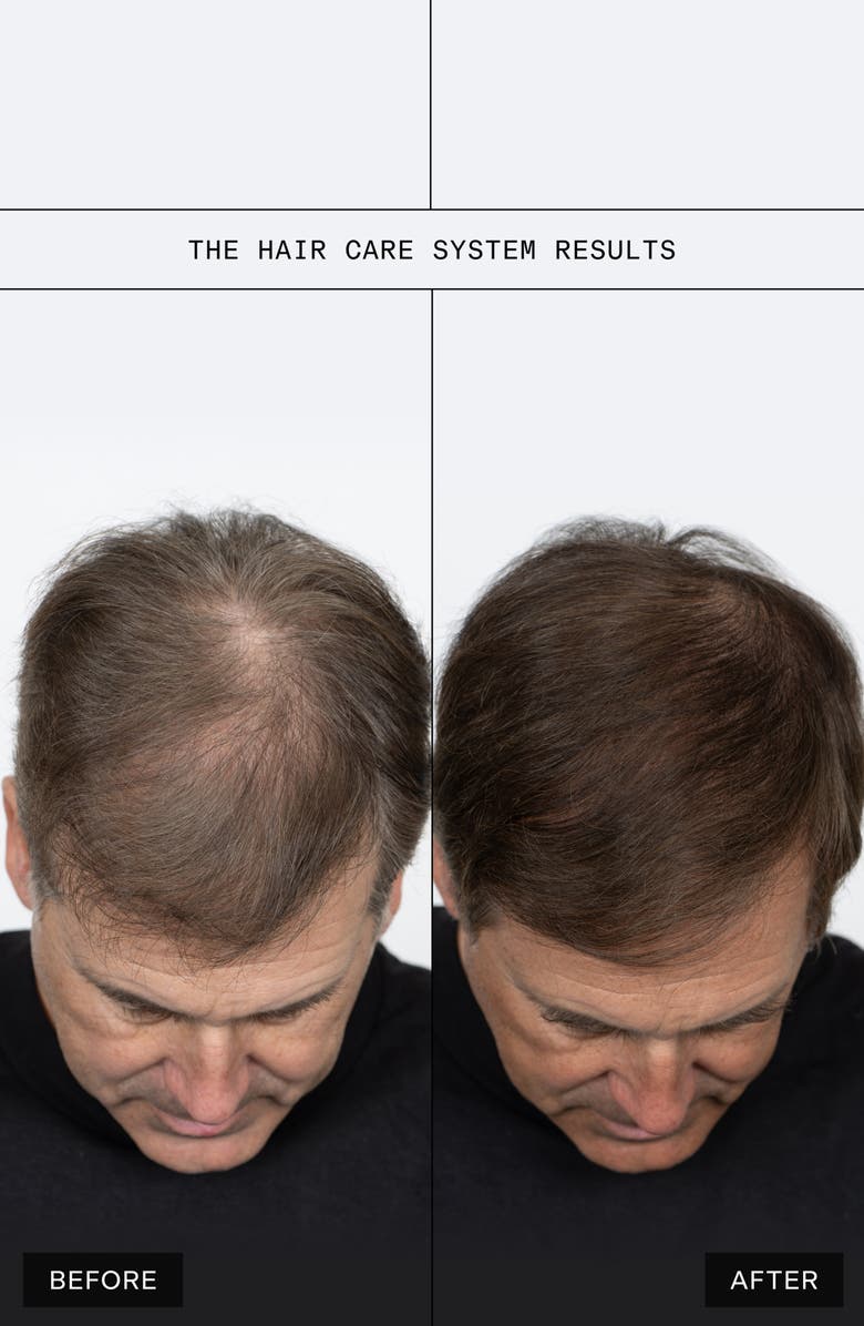 Caldera + Lab The Hair Care System Set, Alternate, color, 