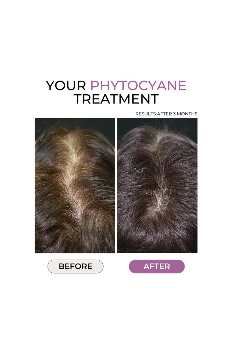 PHYTOCANE Dietary Supplement for Thinning Hair, Alternate, color, NO COLOR