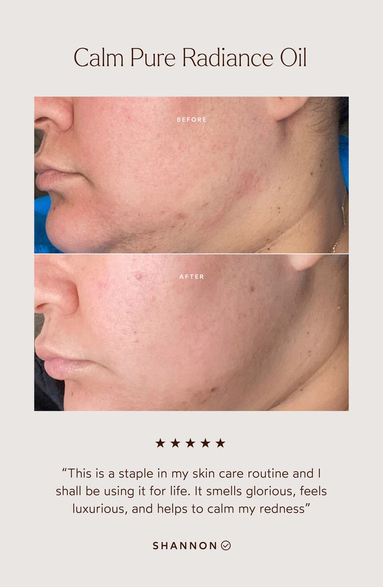 True Botanicals Calm Pure Radiance Face Oil, Alternate, color, 