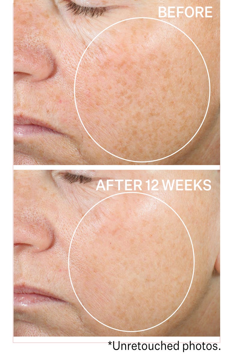 StriVectin<sup>®</sup> Super-C Brighten & Correct Serum, Alternate, color, 