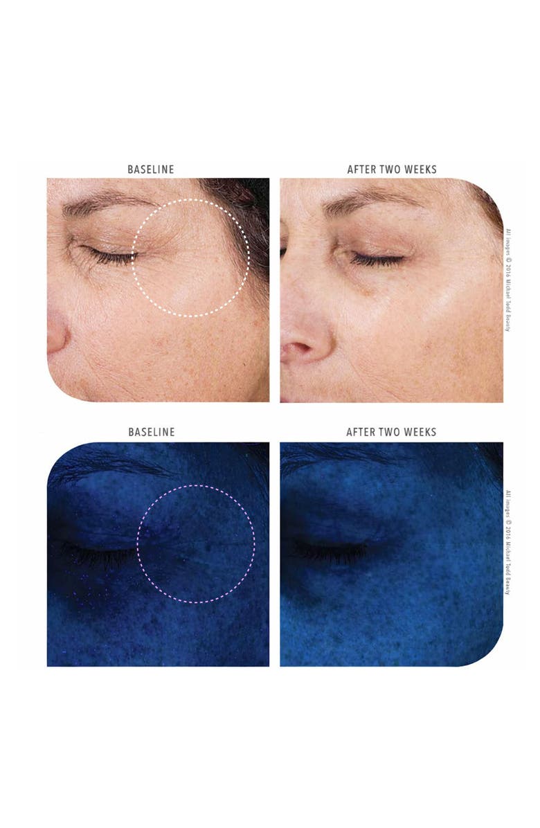MICHAEL TODD BEAUTY KNU Anti-aging Serum, Alternate, color, Shade Between Blue And Red.