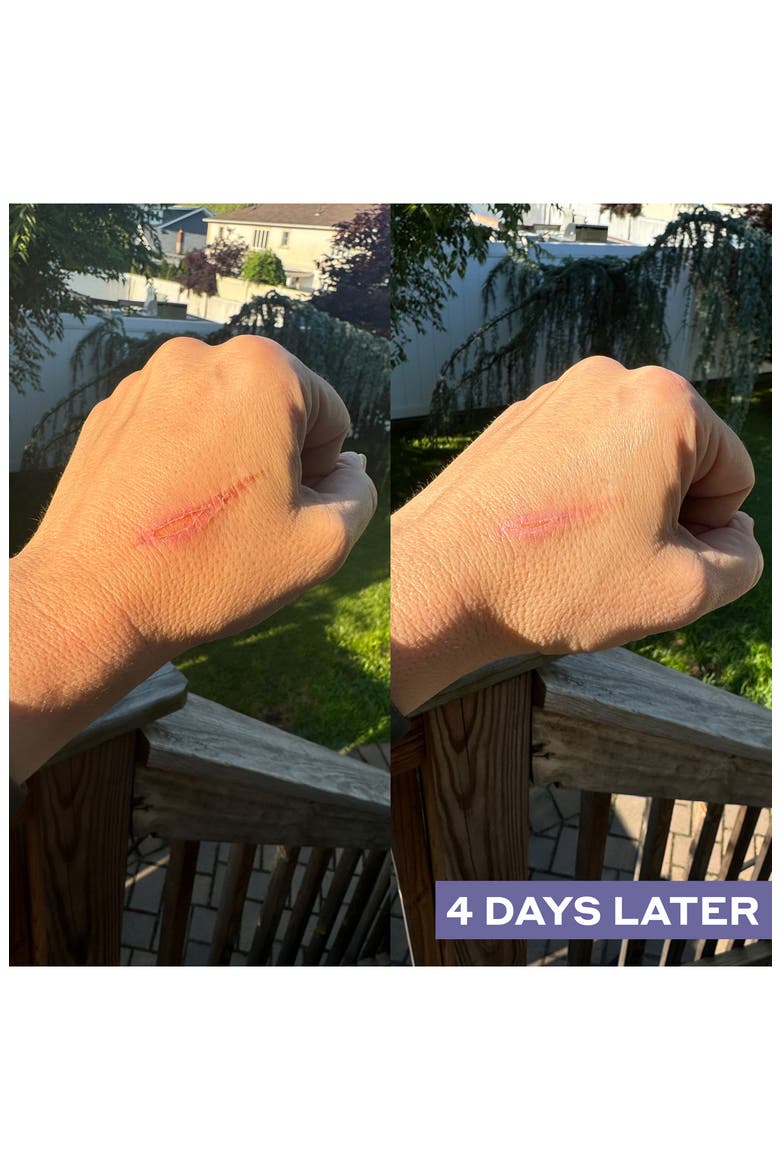Repairing Facial Spray with Hypochlorous Acid, Alternate, color, NO COLOR