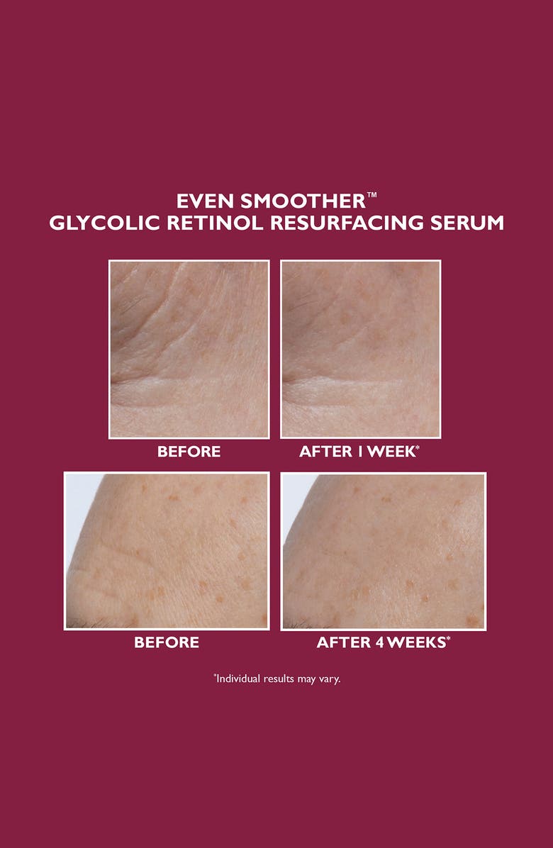 Peter Thomas Roth Even Smoother Glycolic Retinol Resurfacing Serum, Alternate, color,