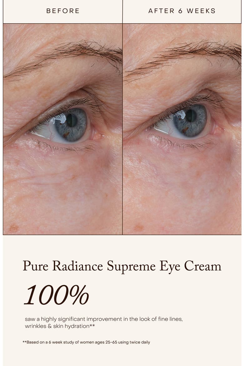 Total Eye Renewal System Set (Nordstrom Exclusive) $215 Value, Alternate, color, NO COLOR