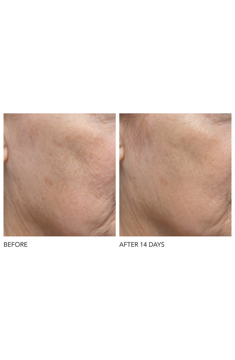 Dr. Dennis Gross Skincare Alpha Beta<sup>®</sup> Exfoliating Moisturizer Cream, Alternate, color,