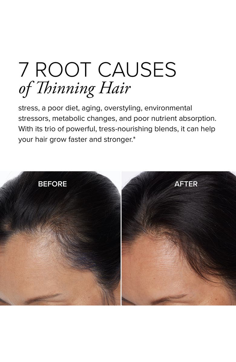 SeroVital Hair Regeneres<sup>™</sup> ADVANCED Hair Growth Supplement, Alternate, color, 