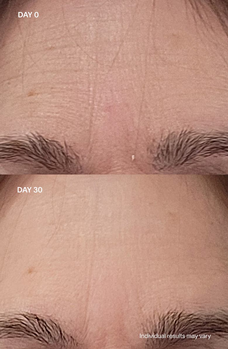 SolaWave Wrinkle Retreat Pro Light Therapy Face Mask, Alternate, color, 