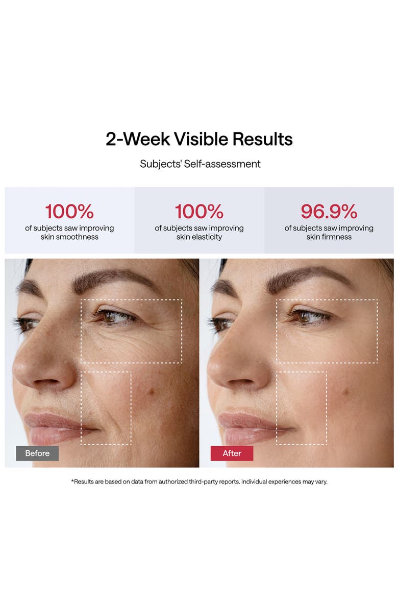 JMOON by Ulike UCollagen+ Microcurrent + LED Light Therapy Device, Alternate, color, UCOLLAGEN / PINK