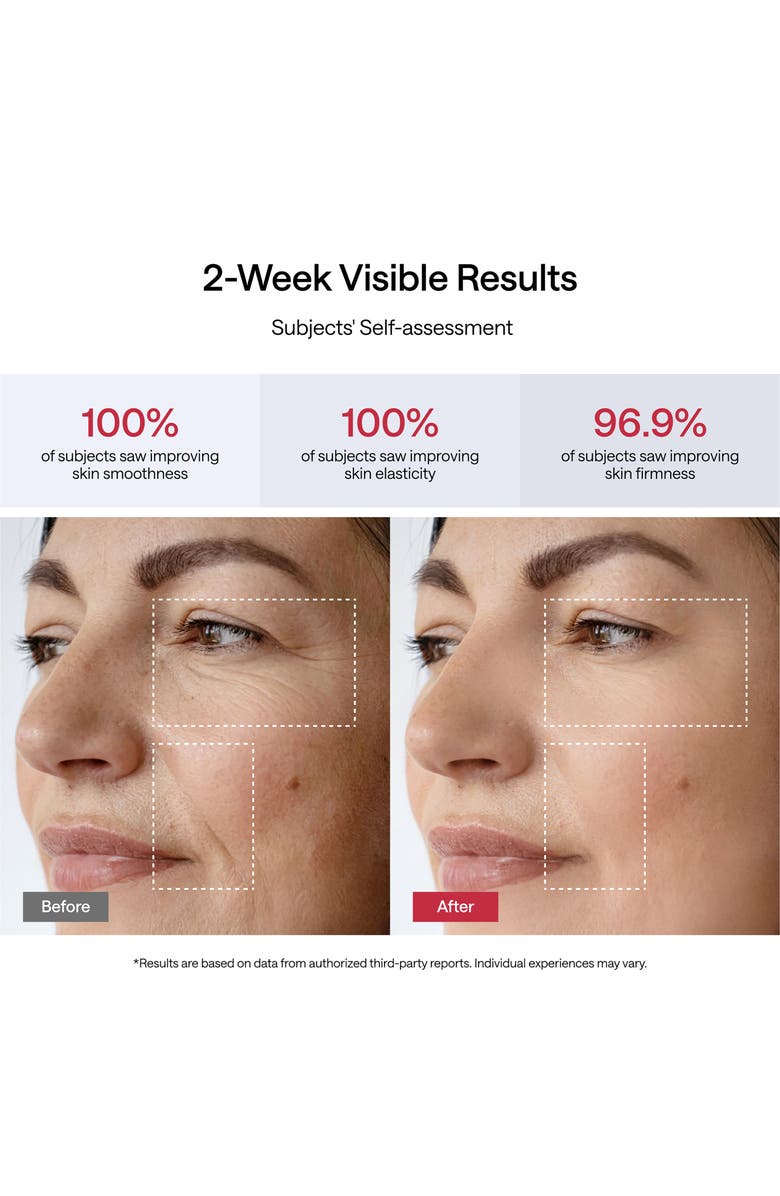 JMOON NouvelleSkin Microcurrent & LED Facial Toning Device, Alternate, color, 