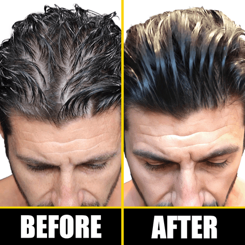 Pete & Pedro Boost Hair & Beard Growth Strengthening Serum With Biotin & Rosemary