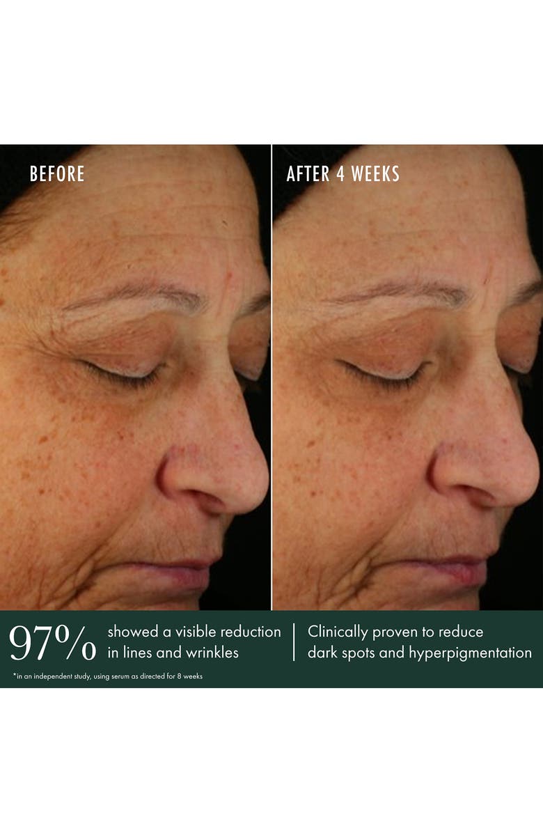 RéVive<sup>®</sup> Brightening Serum Vitamin C, Niacinamide + Bio-Renewal Peptide, Alternate, color, 