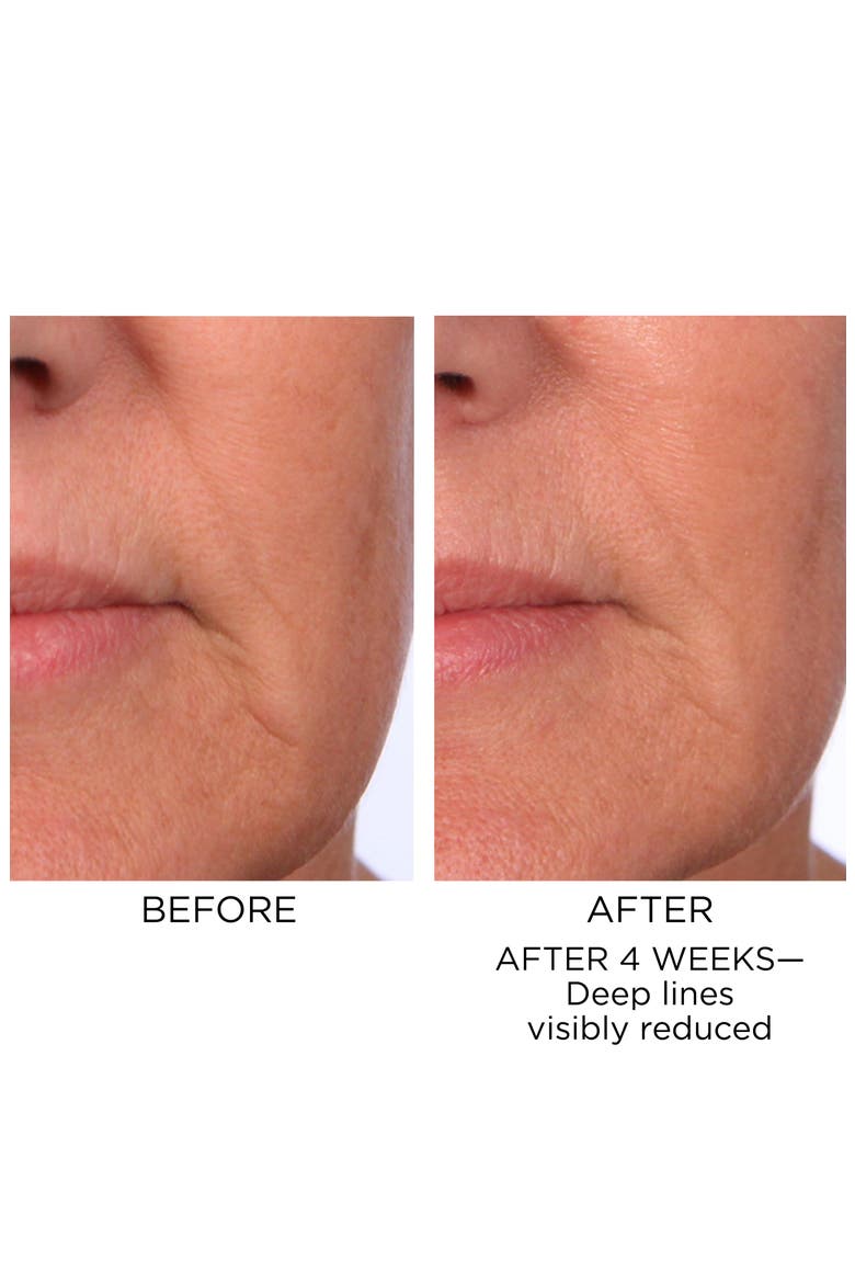 PREVAGE® Progressive Renewal Treatment, Alternate, color, NO COLOR