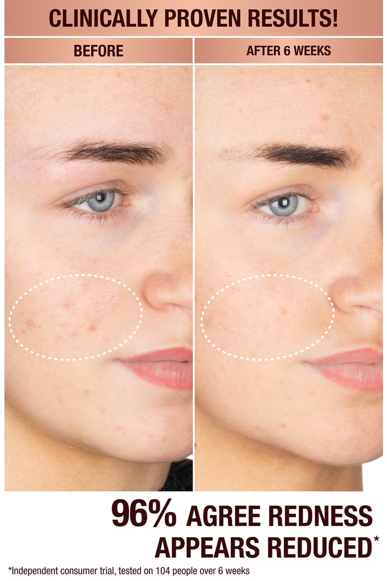 Dark Spot Correcting Radiance Recovery Serum (Nordstrom Exclusive), Alternate, color, NO COLOR