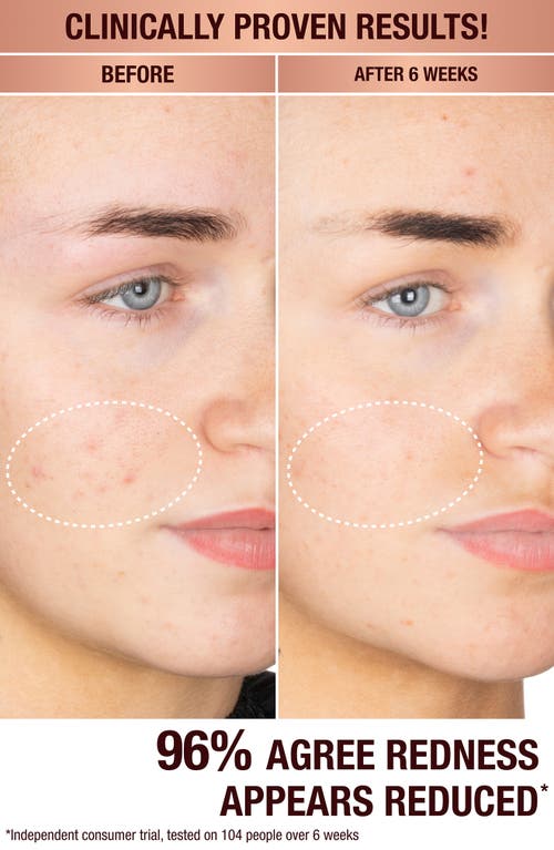 Charlotte Tilbury Dark Spot Correcting Radiance Recovery Serum