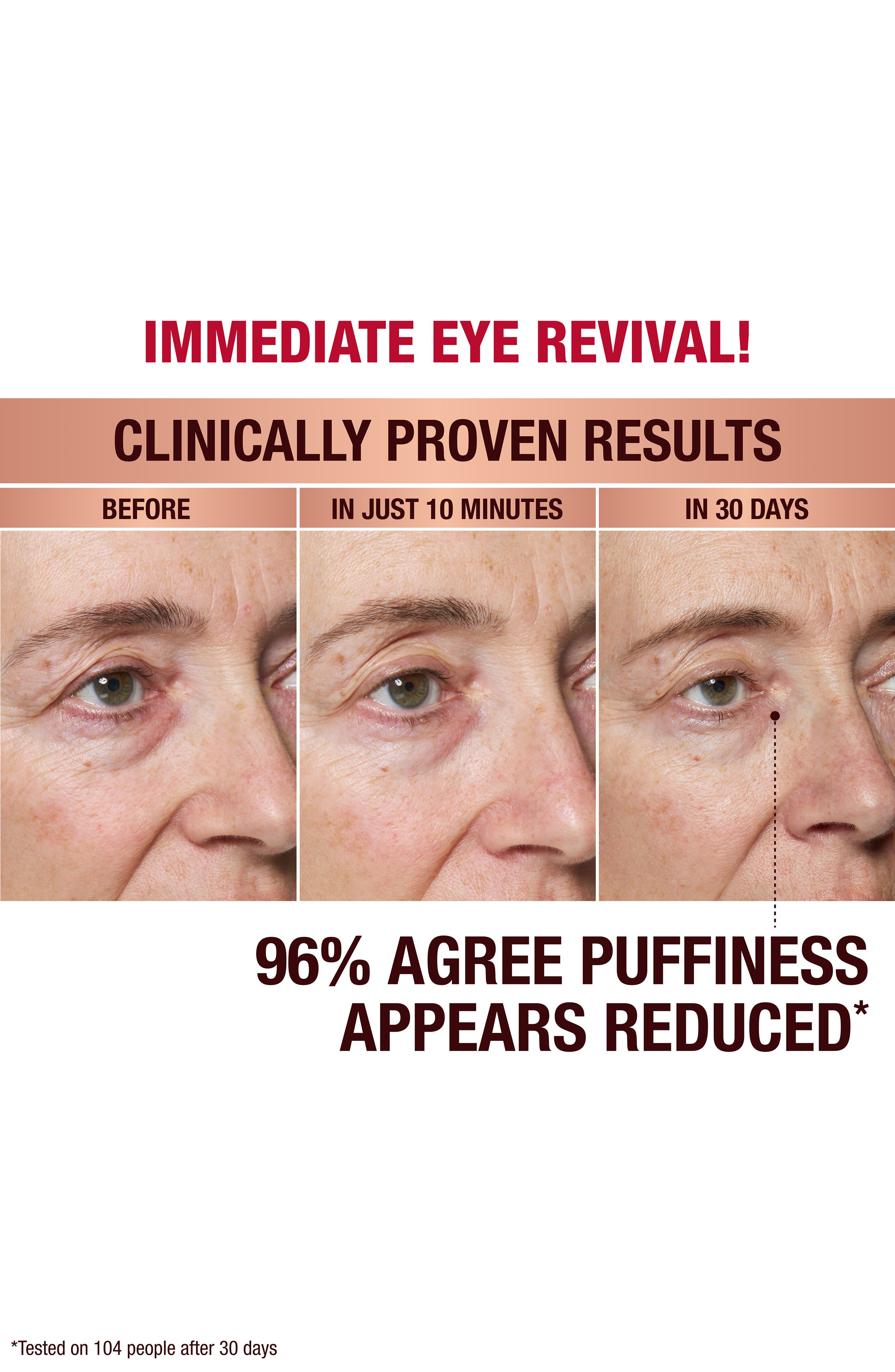Immediate Eye Revival Patches (Women) | Nordstrom