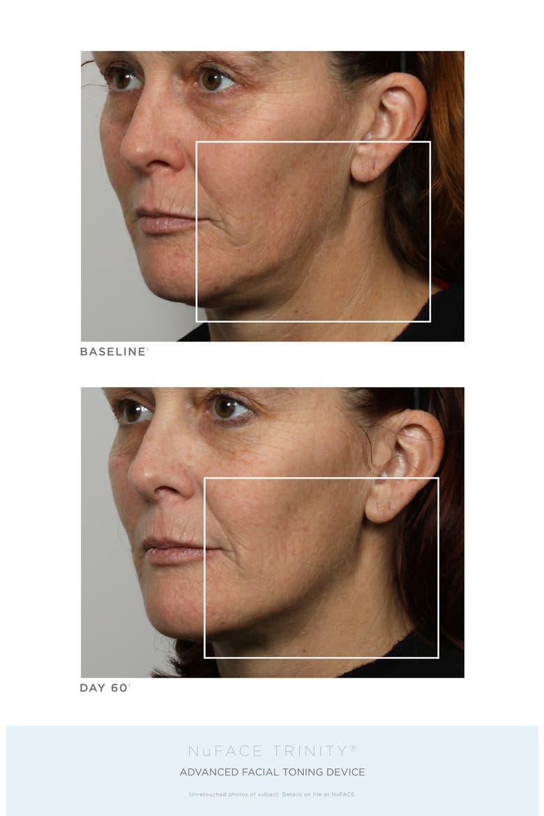 Trinity® Complete Facial Toning Kit (Limited Edition), Alternate, color, NO COLOR