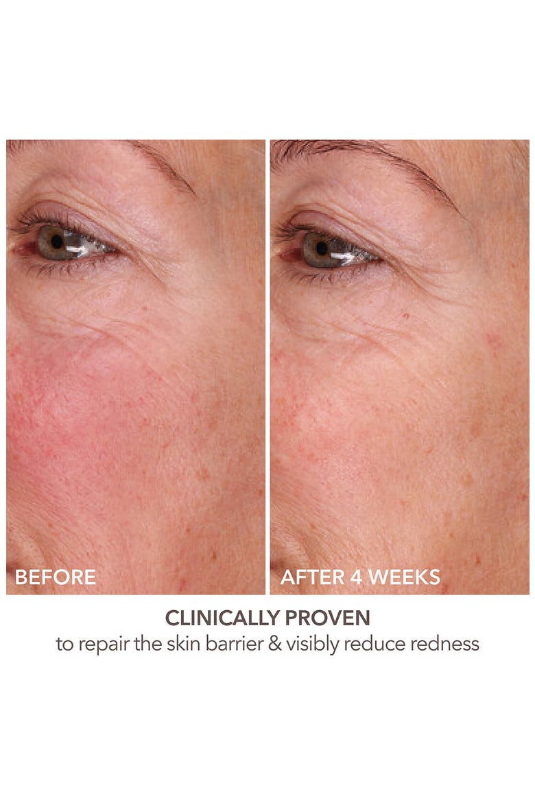 DermInfusions Fill + Repair Serum, Alternate, color, NO COLOR