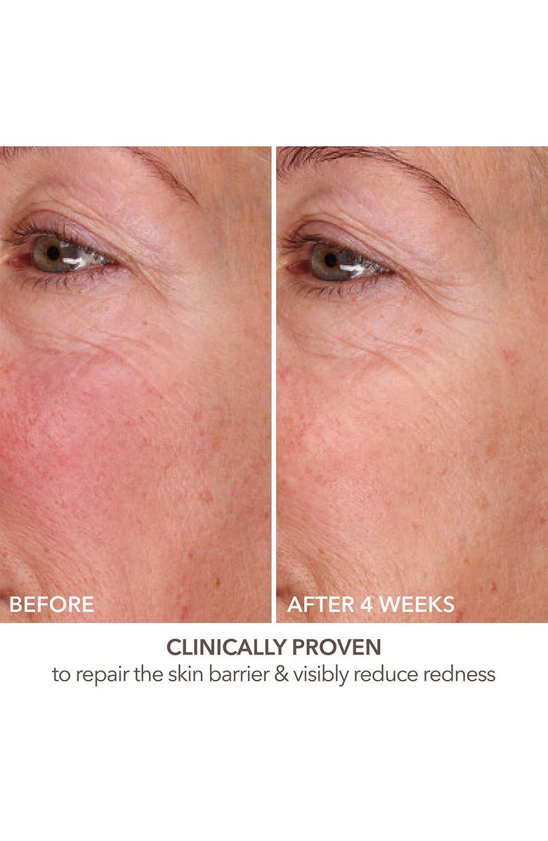 Dr. Dennis Gross Skincare DermInfusions Fill + Repair Serum, Alternate, color, 