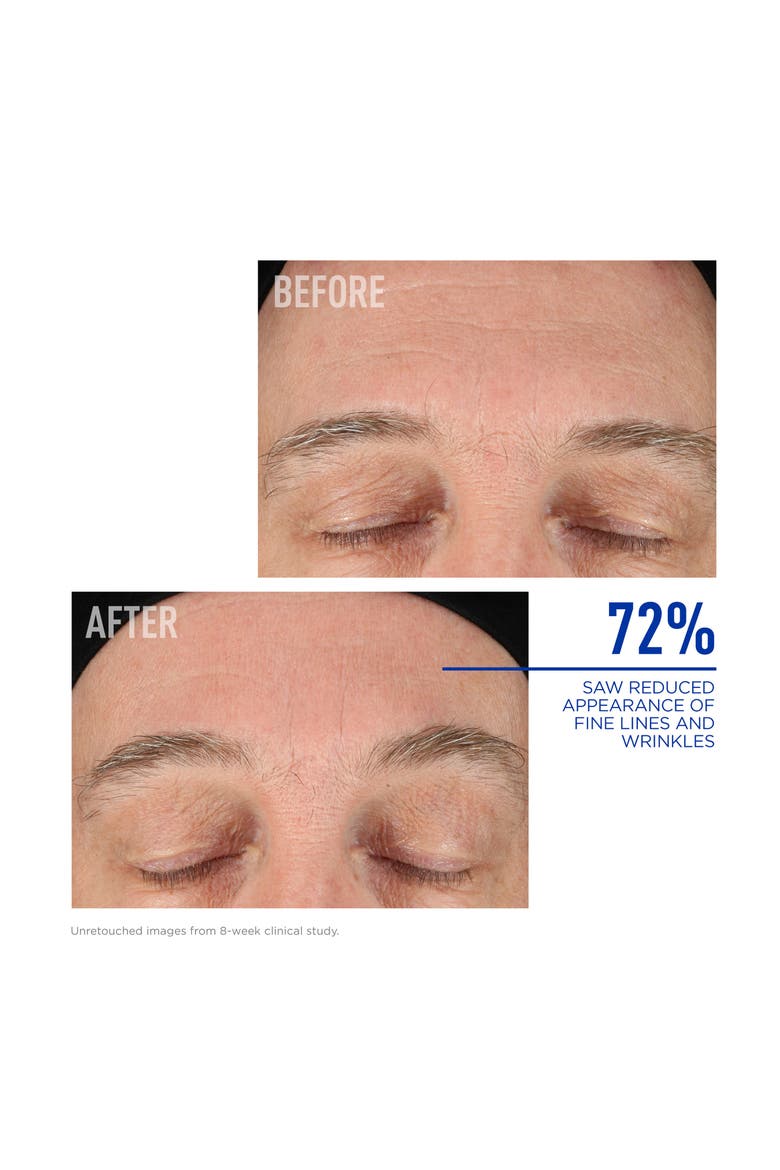 Nighttime BAK-Up™ Retinol Alternative, Alternate, color, NO COLOR