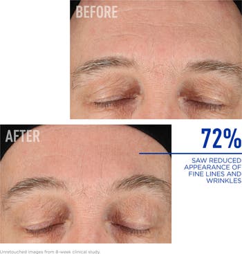 Nighttime BAK-Up<sup>™</sup> Retinol Alternative