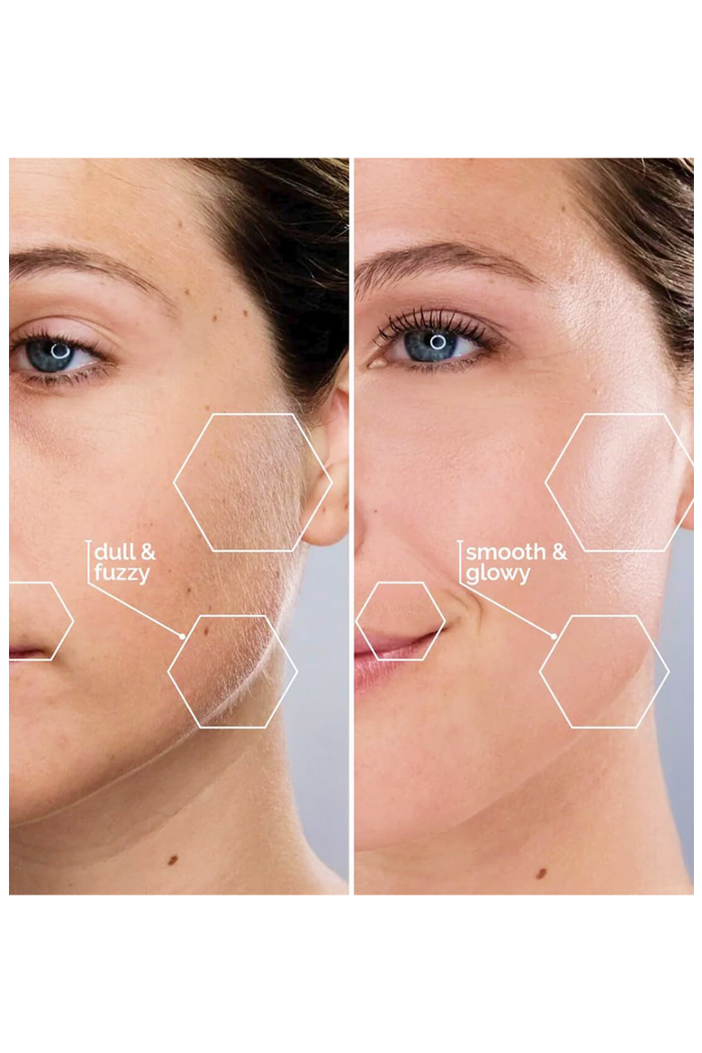 Sonicsmooth At-home Sonic Dermaplaning System, Alternate, color, Reflects all light fully.