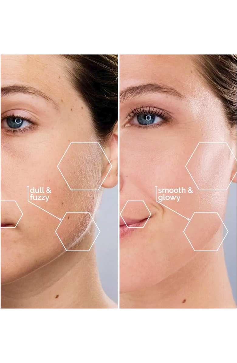 MICHAEL TODD BEAUTY Sonicsmooth At-home Sonic Dermaplaning System, Alternate, color, Reflects All Light Fully.