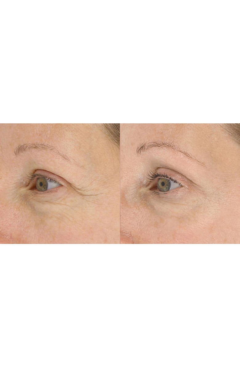 LightStim<sup>®</sup> for Wrinkles LED Light Therapy Device, Alternate, color, White