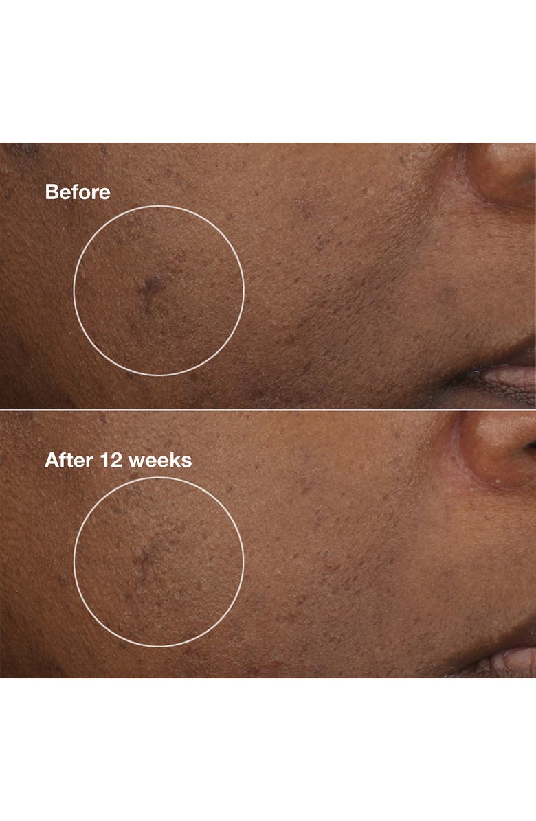 Clinique Even Better Clinical Brightening Moisturizer, Alternate, color, 