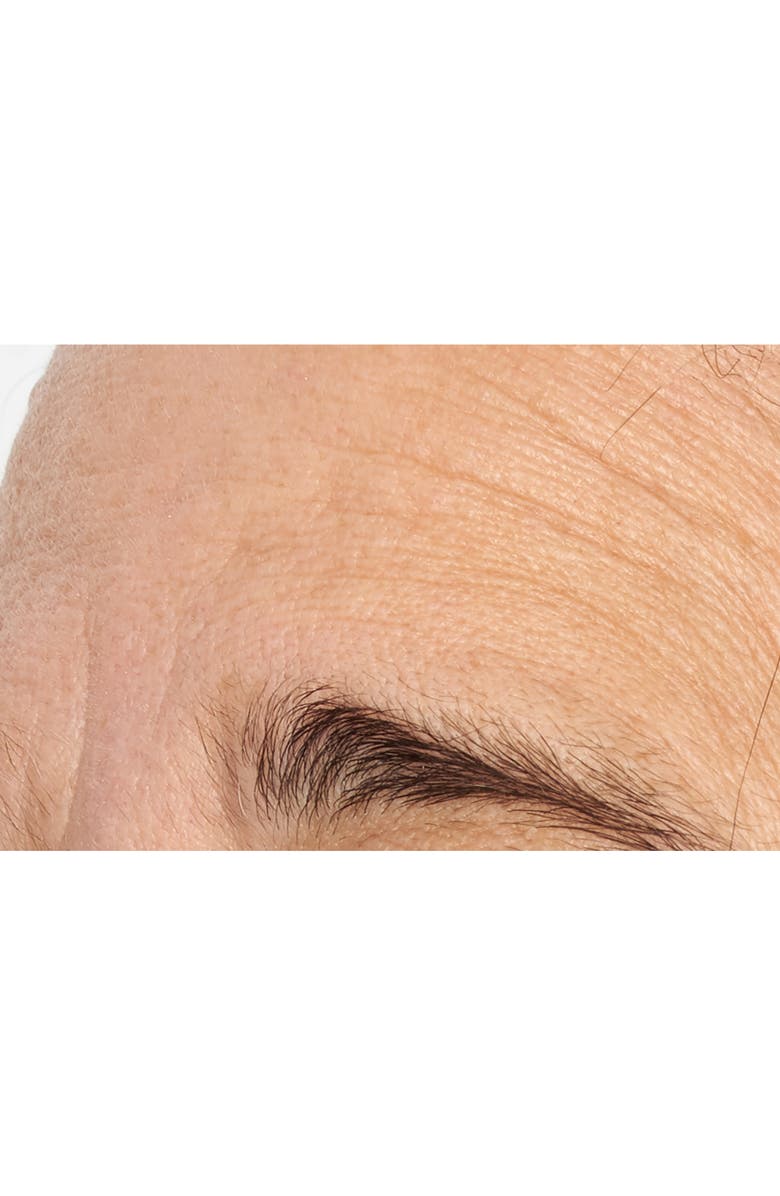 Perricone MD High Potency Intensive Smoothing Serum, Alternate, color, 