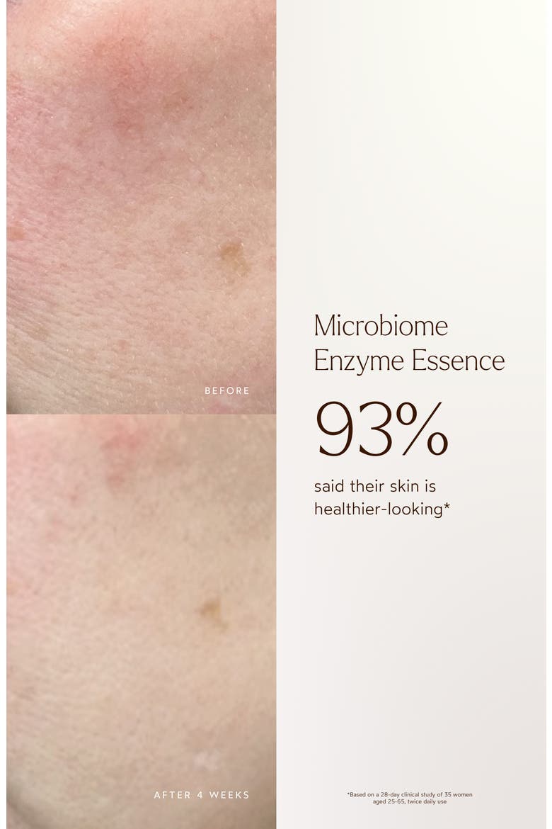 Microbiome Enzyme Essence, Alternate, color, NO COLOR