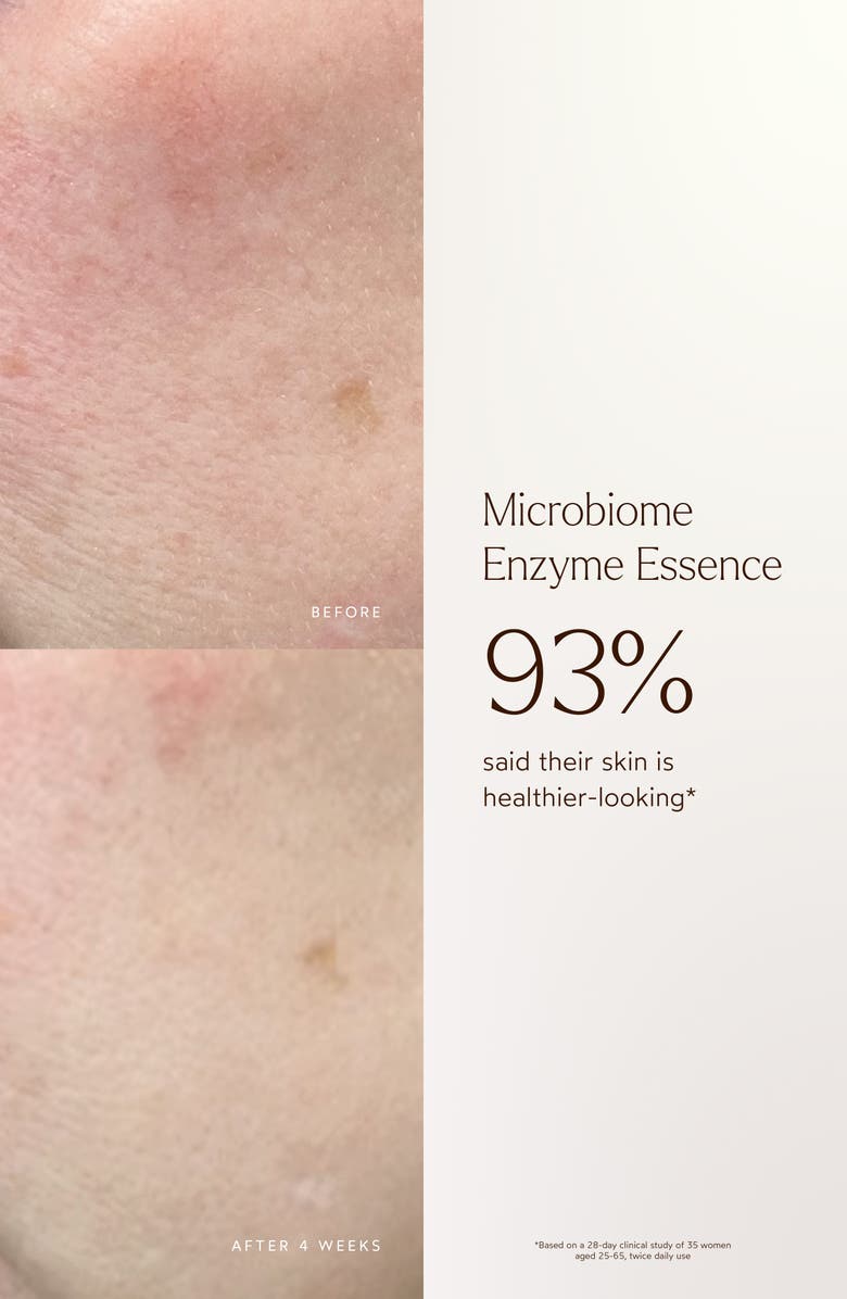 True Botanicals Microbiome Enzyme Essence, Alternate, color, 