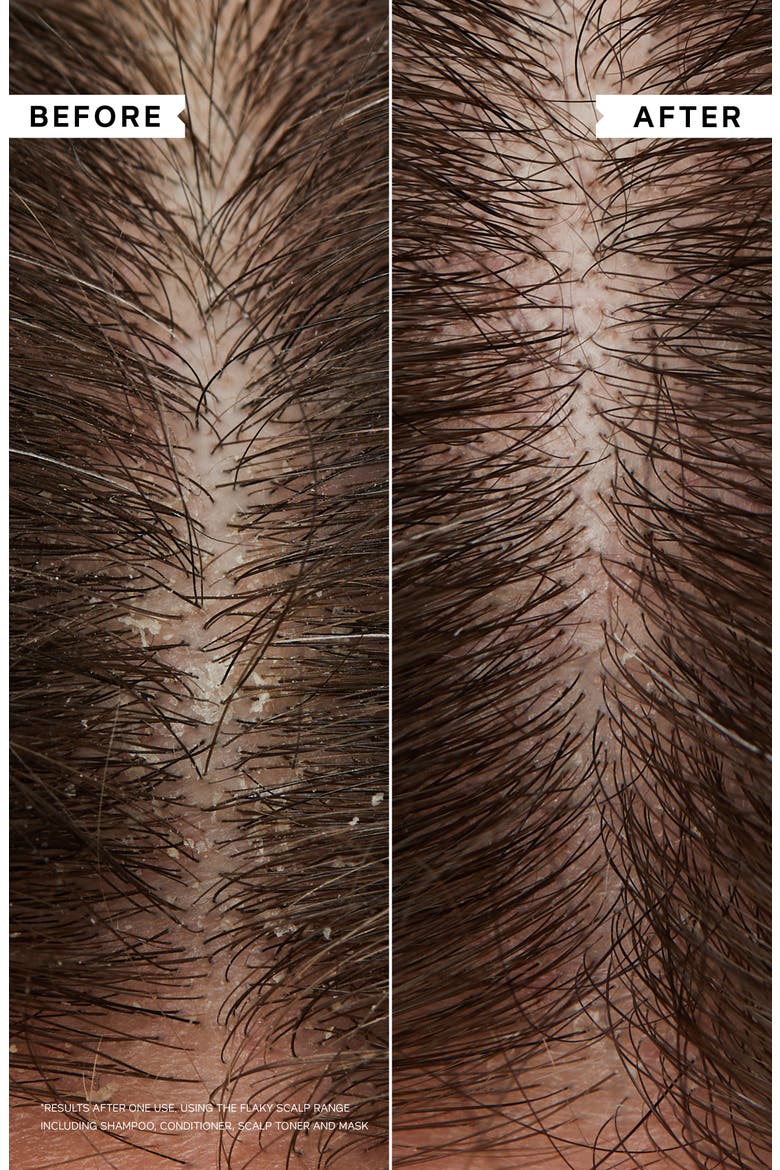 Flaky Scalp Cleansing Shampoo, Alternate, color, NO COLOR