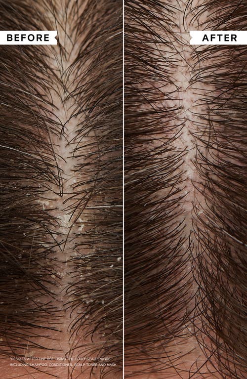 Philip Kingsley Flaky Scalp Cleansing Shampoo In Transparent