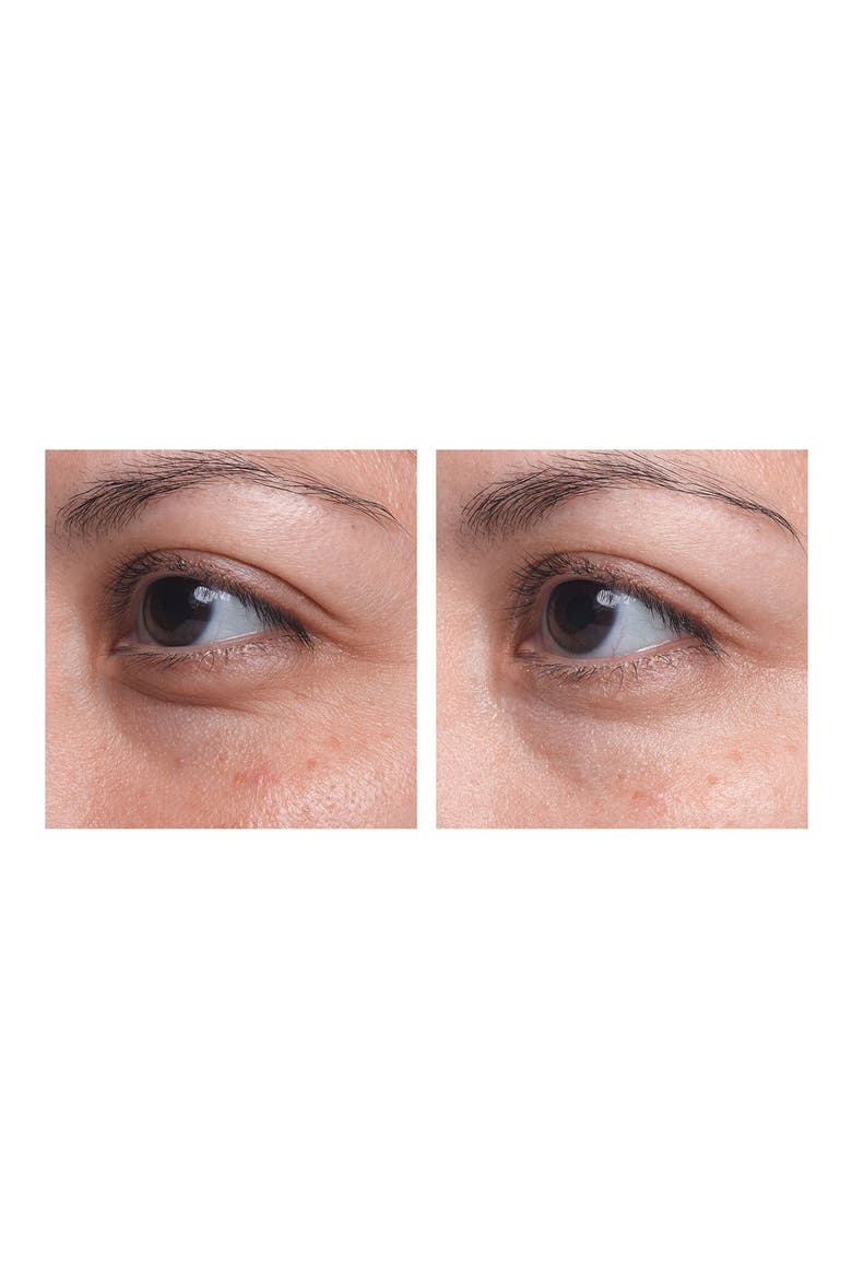 Visionnaire Yeux Eye on Correction® Advanced Multi-Correcting Eye Balm, Alternate, color, NO COLOR