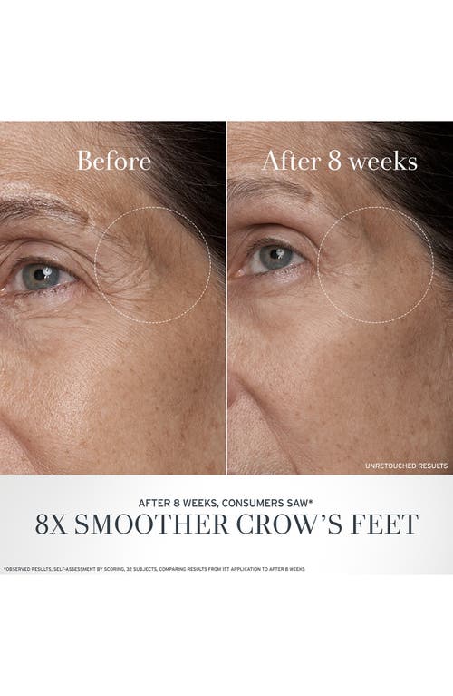 Fresh ® Black Tea Age Renewal Eye Duo (limited Edition) (nordstrom Exclusive) $144 Value In No Color