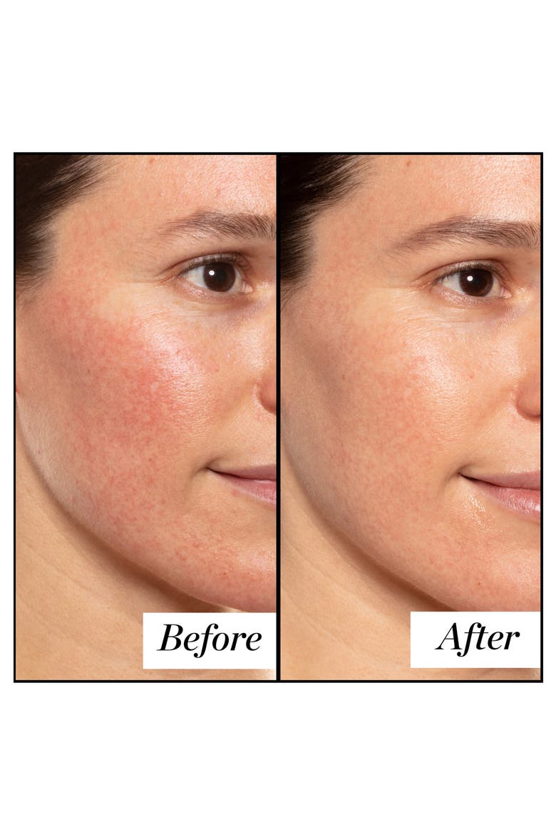 A+ High-Dose Retinoid Serum, Alternate, color, NO COLOR