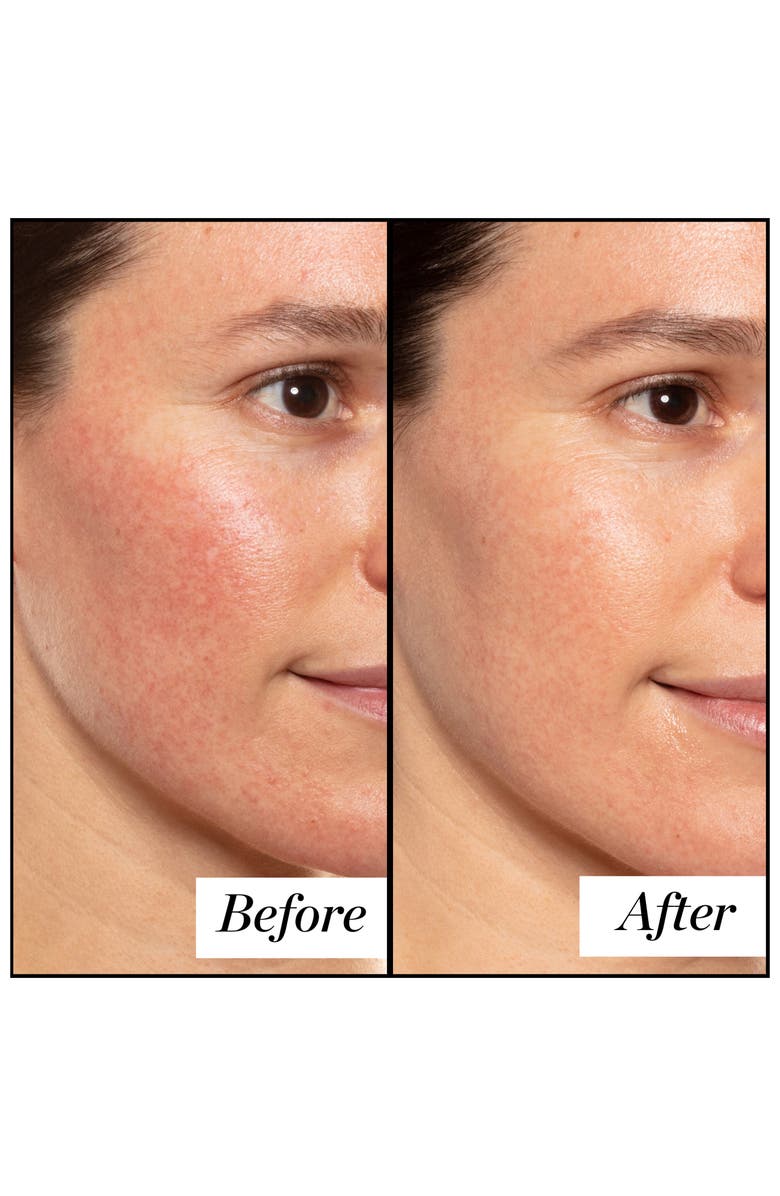 Sunday Riley A+ High-Dose Retinoid Serum, Alternate, color, 