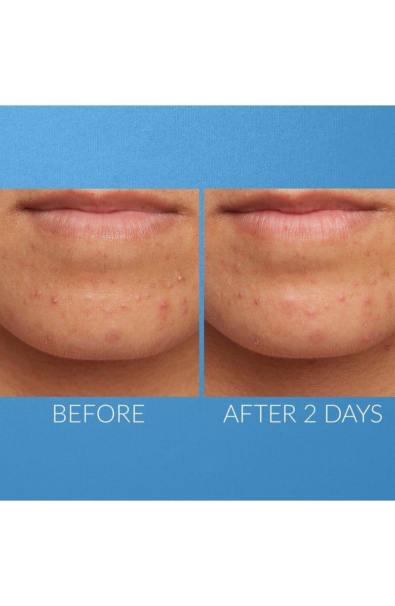 Kate Somerville<sup>®</sup> Kate's Favorite Minis Set, Alternate, color, 