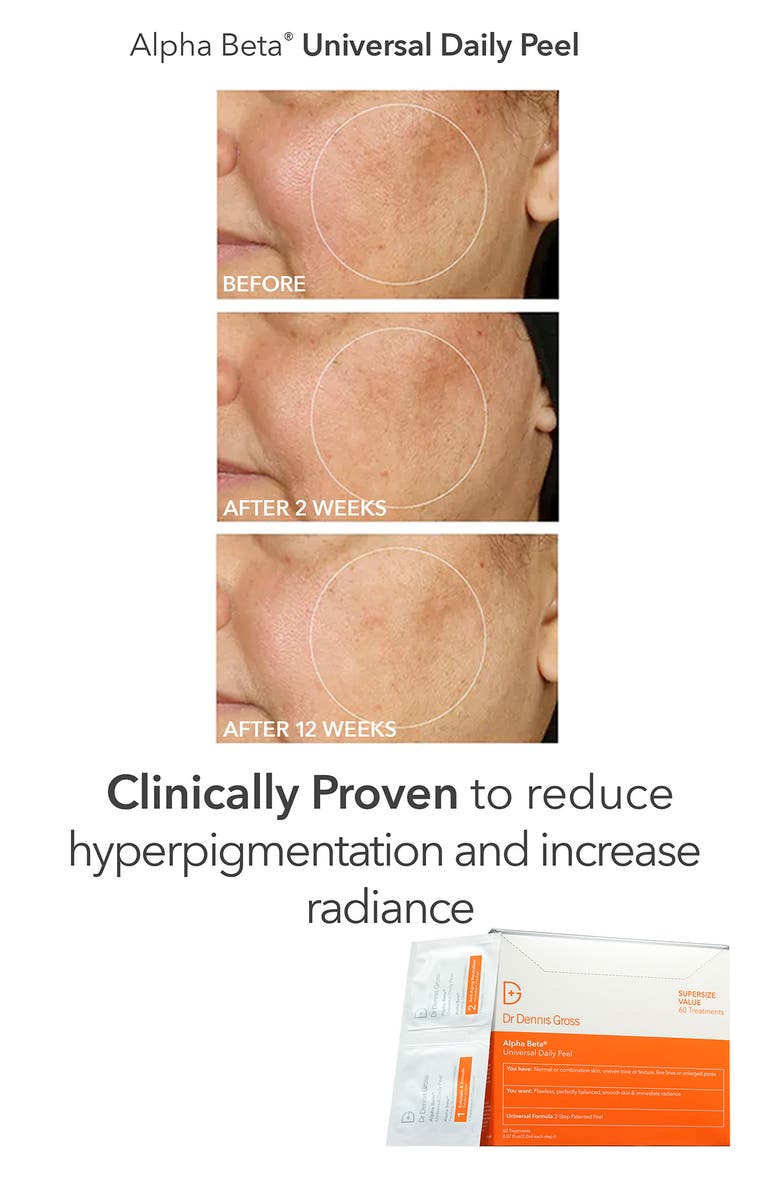 Dr. Dennis Gross Skincare The Peel Vault Set $245 Value, Alternate, color, 