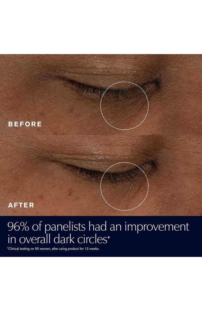 Estée Lauder Advanced Night Repair Eye Supercharged Gel-Creme Eye Cream, Alternate, color,