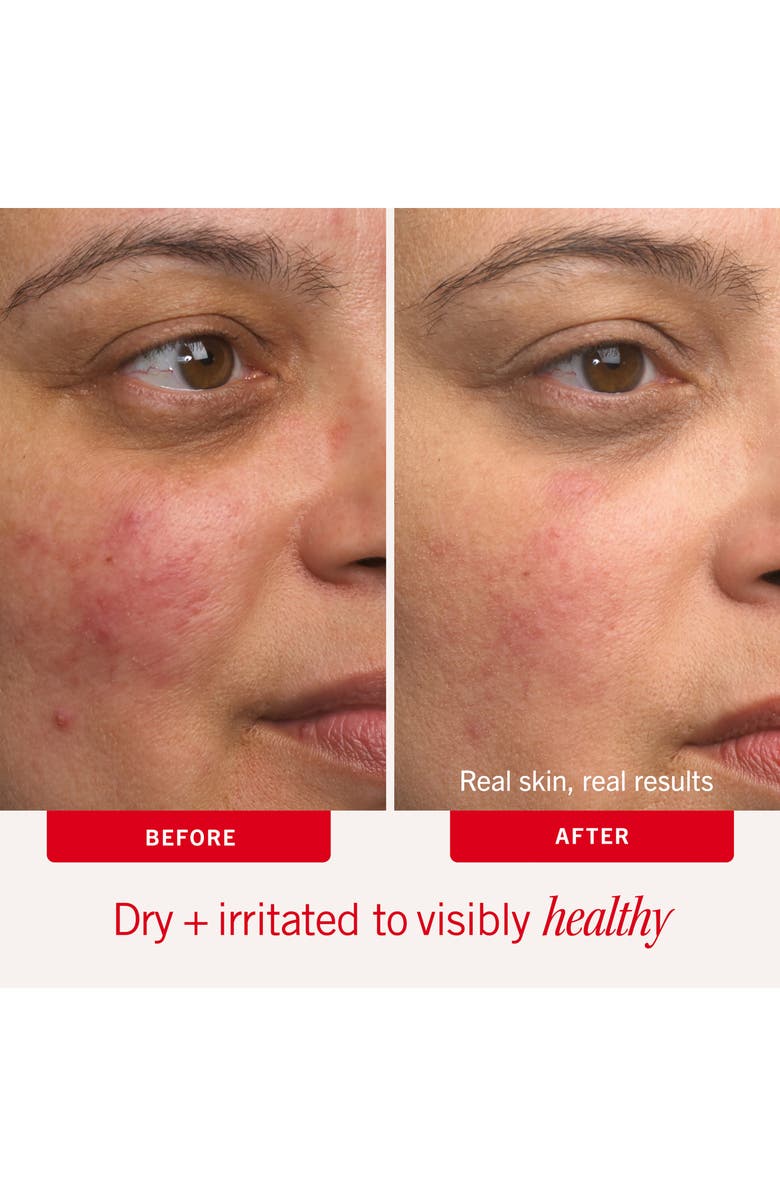 First Aid Beauty Ultra Repair Cream, Alternate, color, 