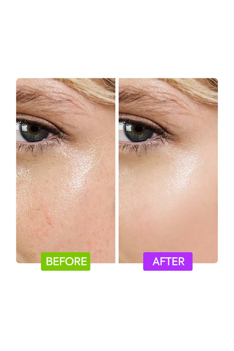 20% Aha + 10% Niacinamide Booster, Alternate, color, None