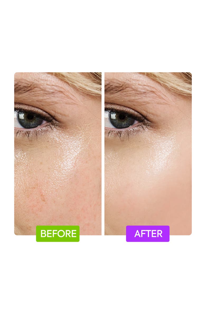 Makari de Suisse 20% Aha + 10% Niacinamide Booster, Alternate, color, NO COLOR