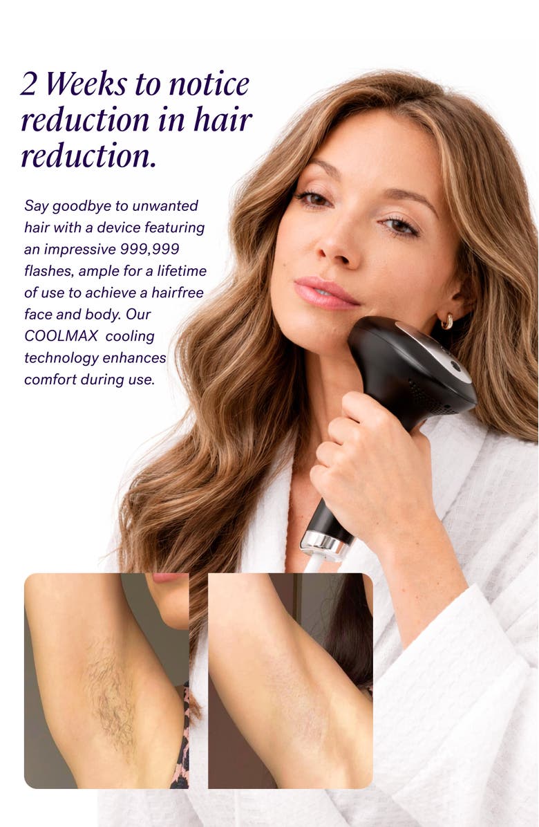 MICHAEL TODD BEAUTY Lumos At Home IPL System, Alternate, color, Absorbs All Light; No Hue.