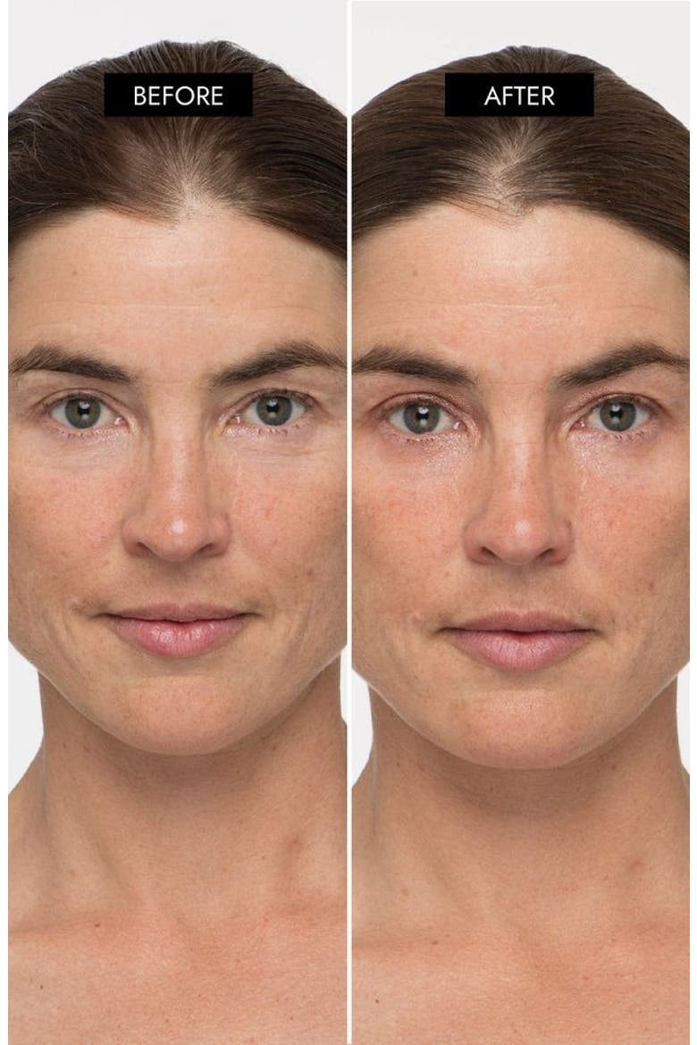 MyoLift TriWave Advanced Microcurrent Facial Device, Alternate, color, None